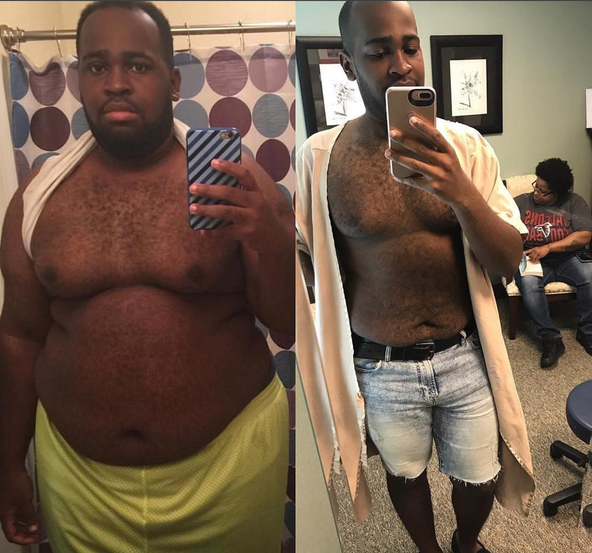 Devonte Owens  WLS Transformation Story #WeAreBariMelts Challenge