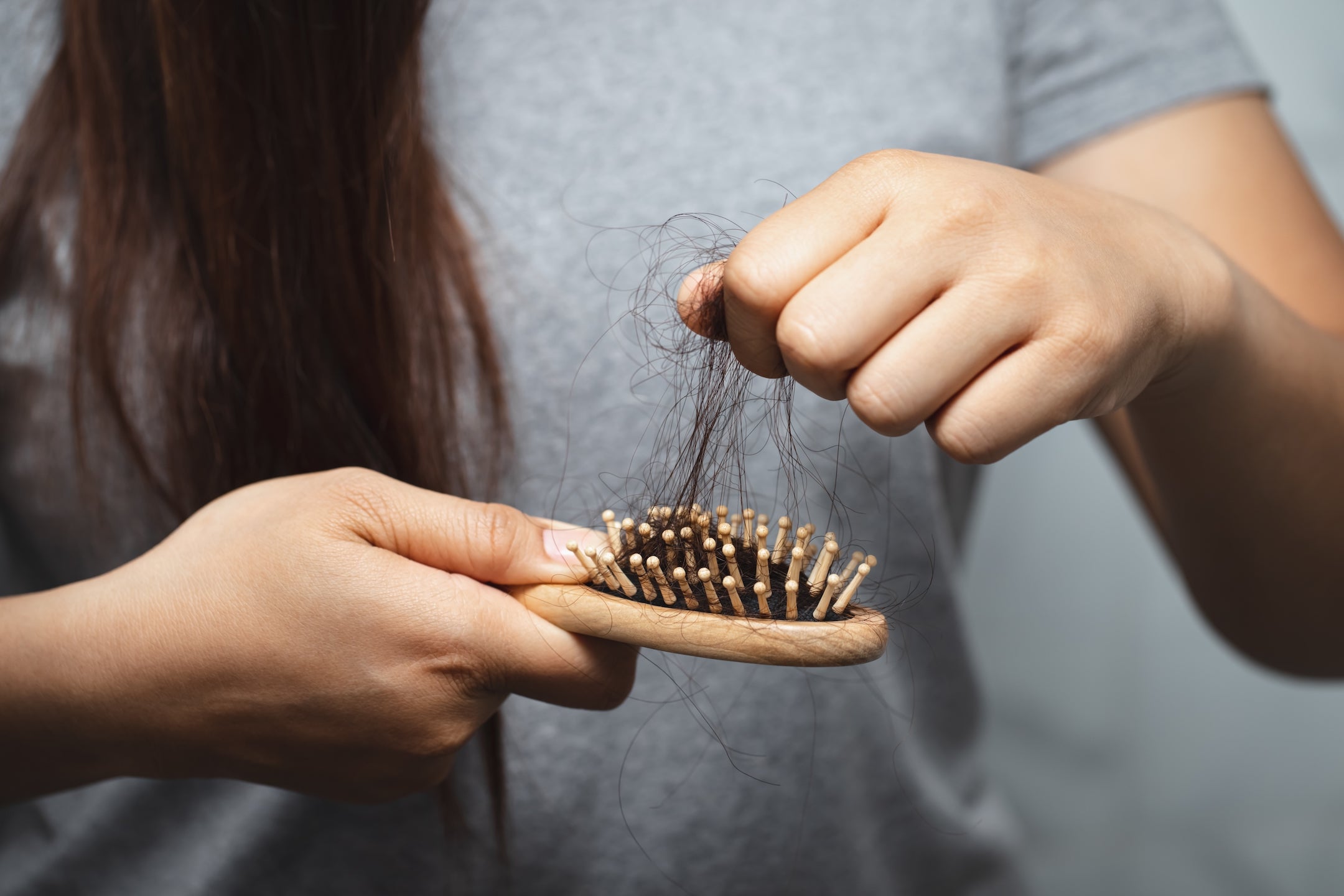 Hair Loss After Revision Surgery